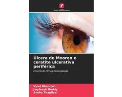 Úlcera de Mooren e ceratite ulcerativa periférica