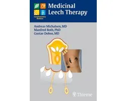 Medicinal Leech Therapy