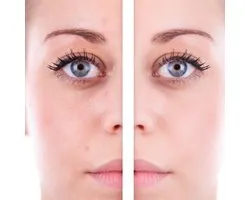 CORRECTOR MINT Kleur: Groen Doel: corrigeert roodheid, couperose, rode vlekjes en rosacea