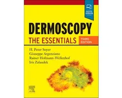 Dermoscopy