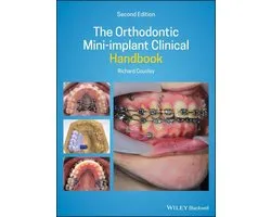 The Orthodontic Mini-implant Clinical Handbook