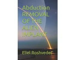 Instruction for the Approaching Apocalypse- Abduction REMOVAL OF THE ALIEN IMPLANT