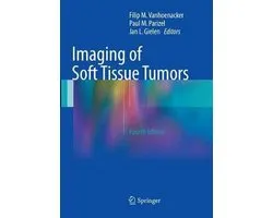 Imaging of Soft Tissue Tumors