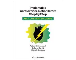 Implantable Cardioverter - Defibrillators Step by Step