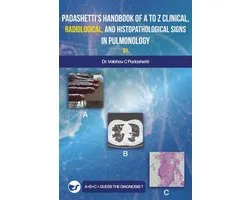 Padashetti's Textbook on A to Z Signs in Pulmonology