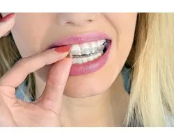 Grehge oth, Bite and Dentures – Breathable Case with Vent Holes – Portable, Durable and Easy to Clean – 75 x 60 x 35 - ShopVlot