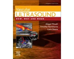 Vascular Ultrasound