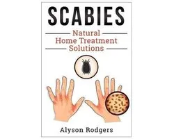 Scabies Natural Home Treatment Solution