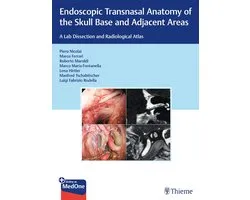 Endoscopic Transnasal Anatomy of the Skull Base and Adjacent Areas