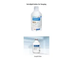 Intralipid-Iodine for Imaging