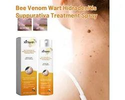 Ximonth Classic - Wratten & Huidtags Spray - Met Bijengif & Tea Tree Olie - Verwijdert Wratten, Verzacht Huid & Herstelt Gladde Huid - Snel Absorberend, Dagelijks Gebruik & 20ml