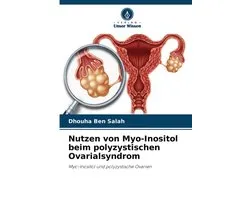 Nutzen von Myo-Inositol beim polyzystischen Ovarialsyndrom