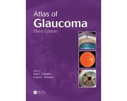 Atlas Of Glaucoma