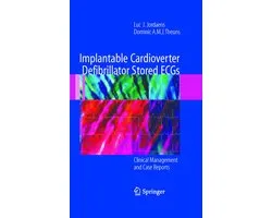 Implantable Cardioverter Defibrillator Stored Ecgs