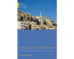Medical Anthropology- Making Down Syndrome