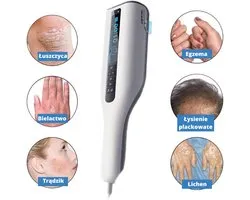 Kernel Medical UVB Lichttherapie Handlamp – Philips™ 311nm UVB Lamp