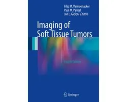 Imaging of Soft Tissue Tumors