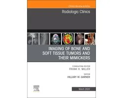The Clinics: Internal Medicine Volume 60-2 - Imaging of Bone and Soft Tissue Tumors and Their Mimickers, An Issue of Radiologic Clinics of North America, E-Book