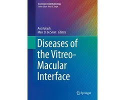 Medicine (R0) - Diseases of the Vitreo-Macular Interface
