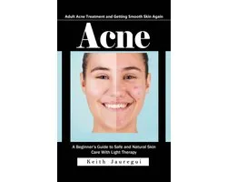 Acne: Adult Acne Treatment and Getting Smooth Skin Again (A Beginner’s Guide to Safe and Natural Skin Care With Light Therapy)