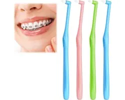 carmdering - Einbüschelbürste - Single Tuft Brush - Interdental Bürste - Präzise Detailreinigung - Sanfte Zahnfleischpflege - Nylon Borsten - Ergonomischer Griff - Ideal Für Zahnspangen - 4 Stück
